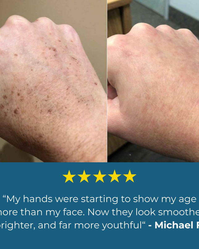 Aloria Age Spot Cream™
