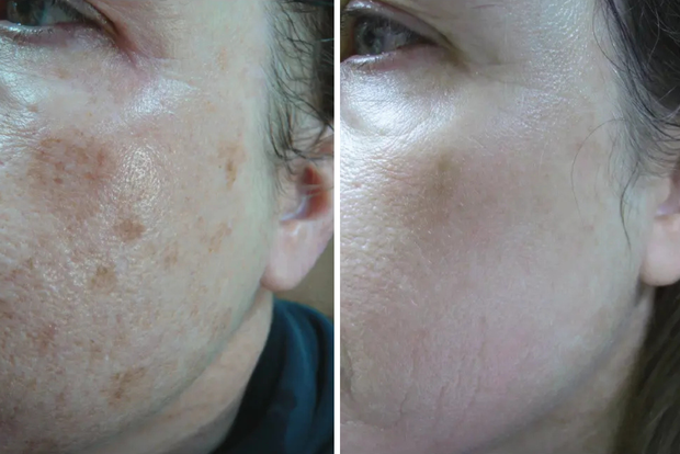 ⭐⭐⭐⭐⭐ - Colleen B.