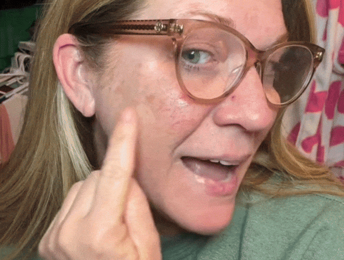 <h2>Visibly Fade Age<br/>Spots In Weeks</h2>